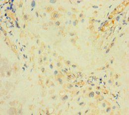 ARSI Antibody