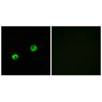 ARSI Antibody