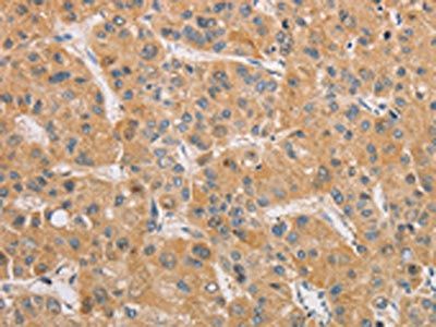 ARSK Antibody