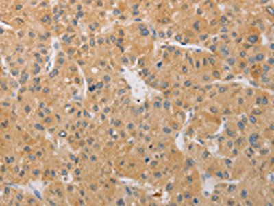 ARSK Antibody