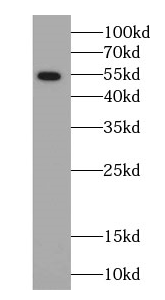 ARSK-Specific antibody