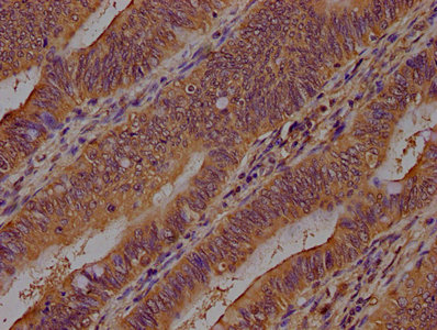 ART1 Antibody