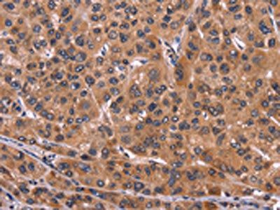 ART5 Antibody