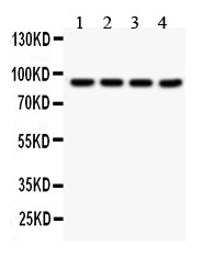 Serotonin transporter/SLC6A4 Antibody