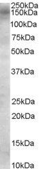 Goat anti-AS160 / TBC1D4 Antibody