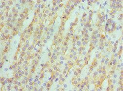 ASAH1 Antibody