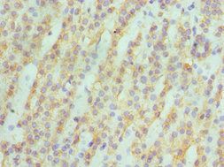 ASAH1 antibody