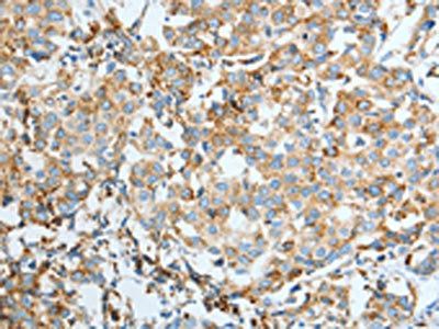 ASAH1 Antibody
