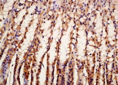 ASAH1 Rabbit Polyclonal Antibody