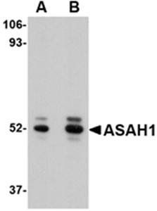 ASAH1 Antibody