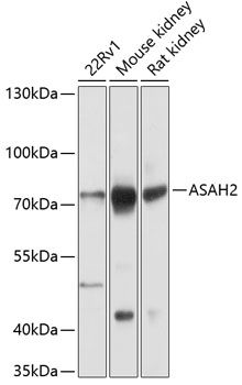 ASAH2 antibody