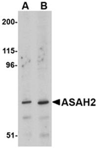 ASAH2 Antibody