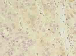 ASB11 Antibody