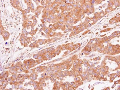 ASB4 Rabbit Polyclonal Antibody