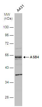 ASB4 Rabbit Polyclonal Antibody