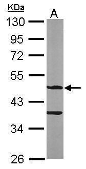 ASB4 Rabbit Polyclonal Antibody