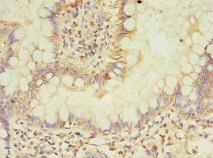 ASB6 Antibody