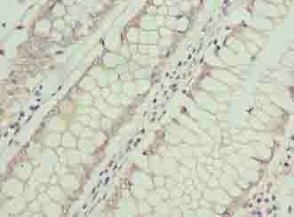 ASB7 Antibody