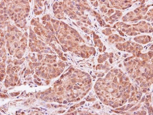 ASB9 Rabbit Polyclonal Antibody