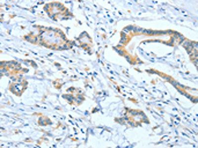 ASCC1 Antibody