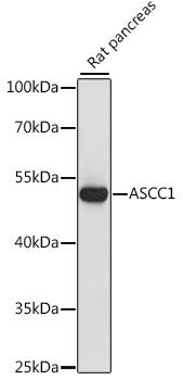 ASCC1 antibody