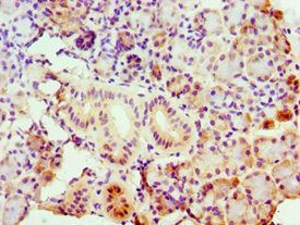 ASCC3 Antibody