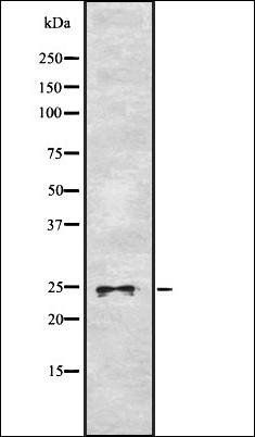ASCL1 antibody