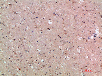 ASCL1 Antibody