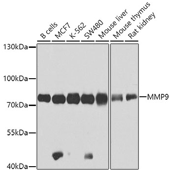 MMP9 antibody