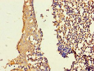 ASF1B Antibody