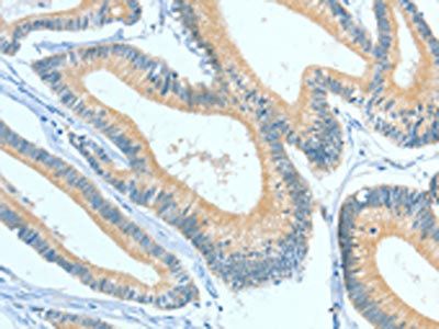 ASGR1 Antibody