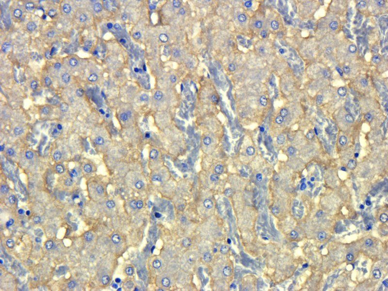 ASGR1 antibody