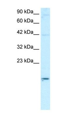 ASGR2 antibody