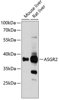 ASGR2 antibody