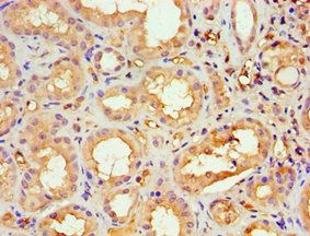 ASH2L Antibody
