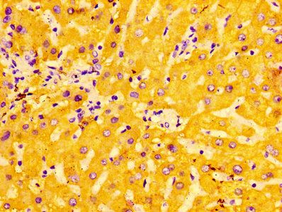 ASGR1 Antibody