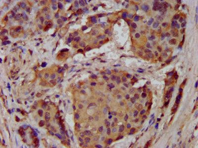 ASIC2 Antibody