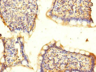 ASIC5 Antibody