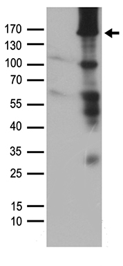 ASK1 (MAP3K5) antibody