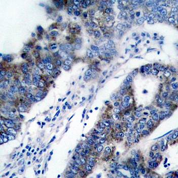 ASK1 (Ab-83) Antibody