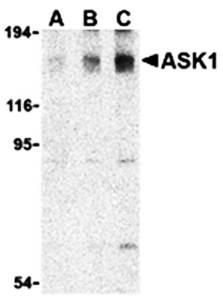 ASK1 Antibody
