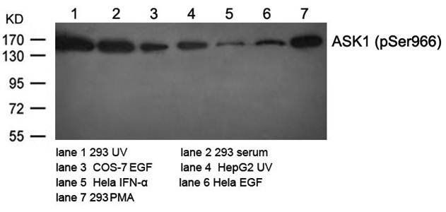 ASK1 (Phospho-Ser966) Antibody