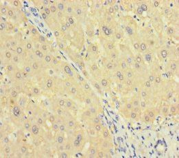 ASL Antibody