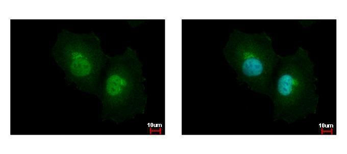 argininosuccinate lyase Antibody