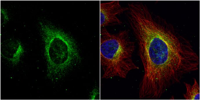 ASL antibody