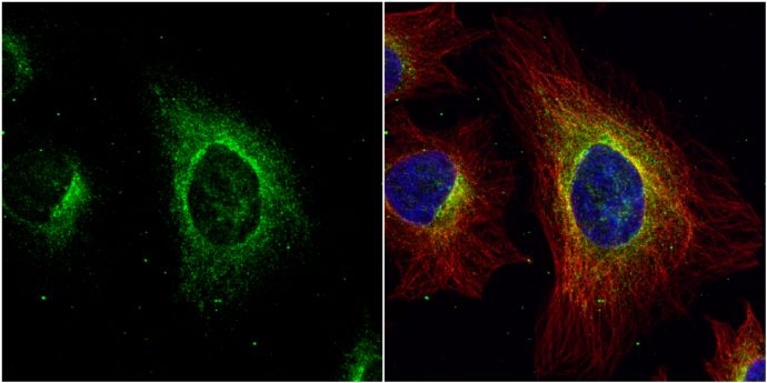 argininosuccinate lyase Antibody