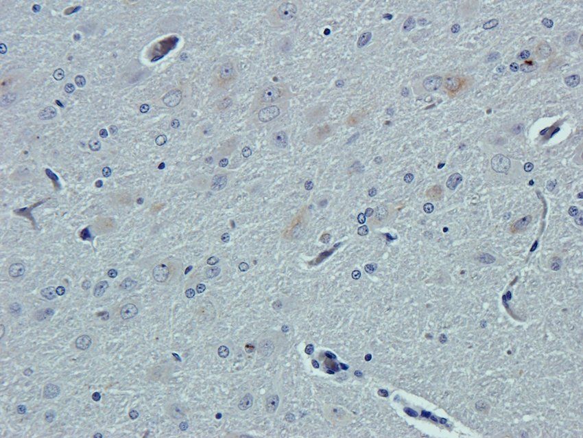 ASL1A Rabbit Polyclonal Antibody