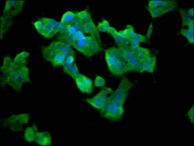 ASMT Antibody