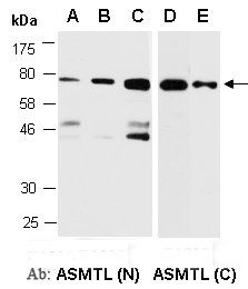 ASMTL antibody