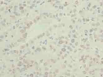 ASNSD1 Antibody